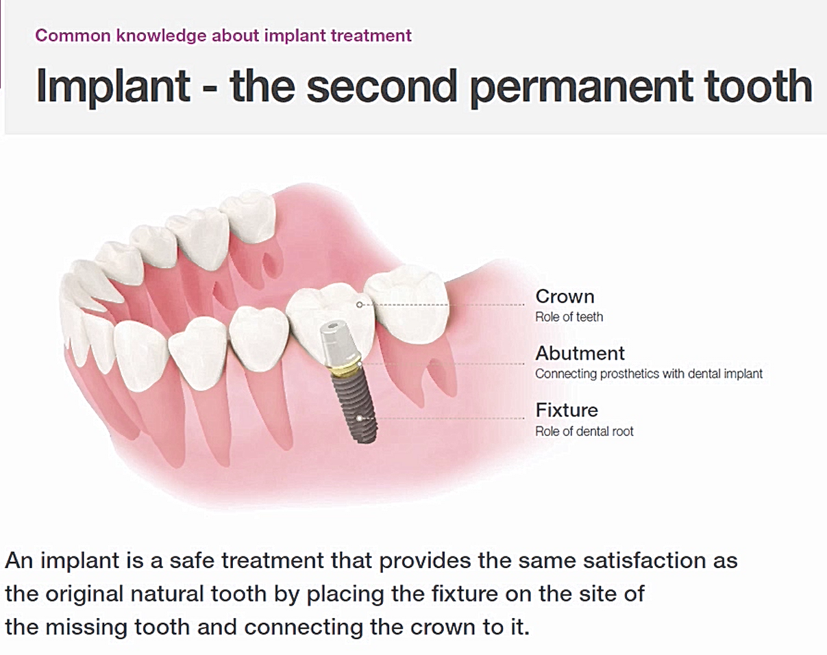 What You Need to Know About Dental Treatments